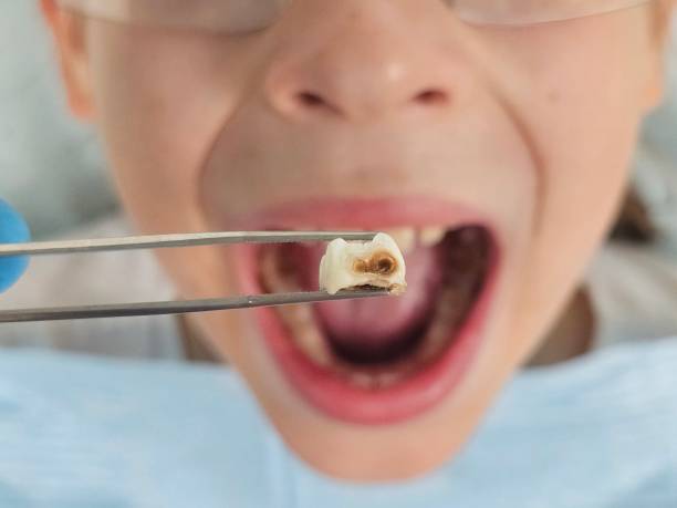 Best Emergency Dental Care for Trauma or Injury in Ellerslie, GA